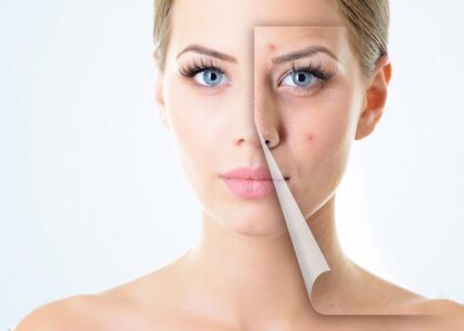 Global Skin Replacement Industry