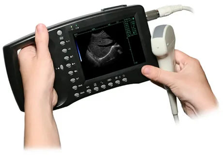 Handheld Ultrasound Scanner Market