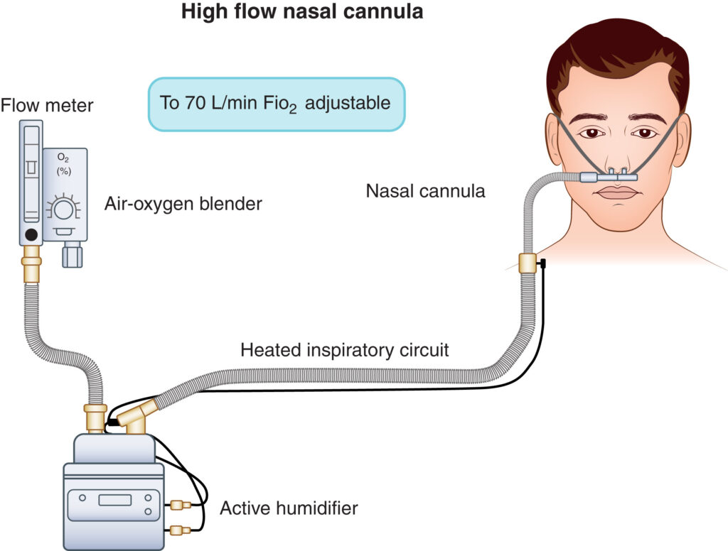 High Flow Nasal Cannula Market