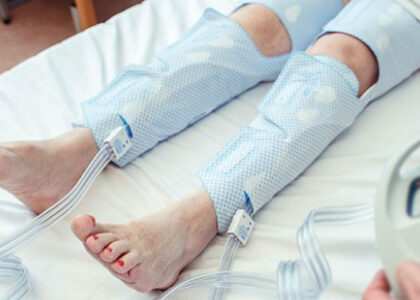 India's Static Compression Therapy Industry