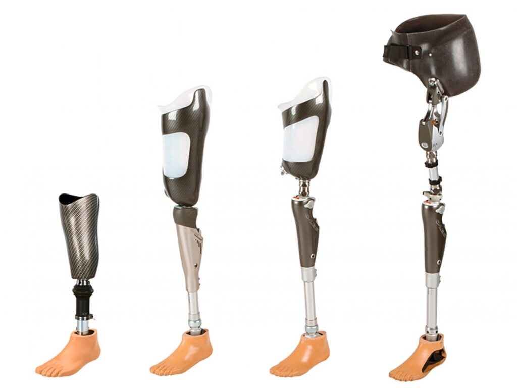 Motorized Prosthesis Market