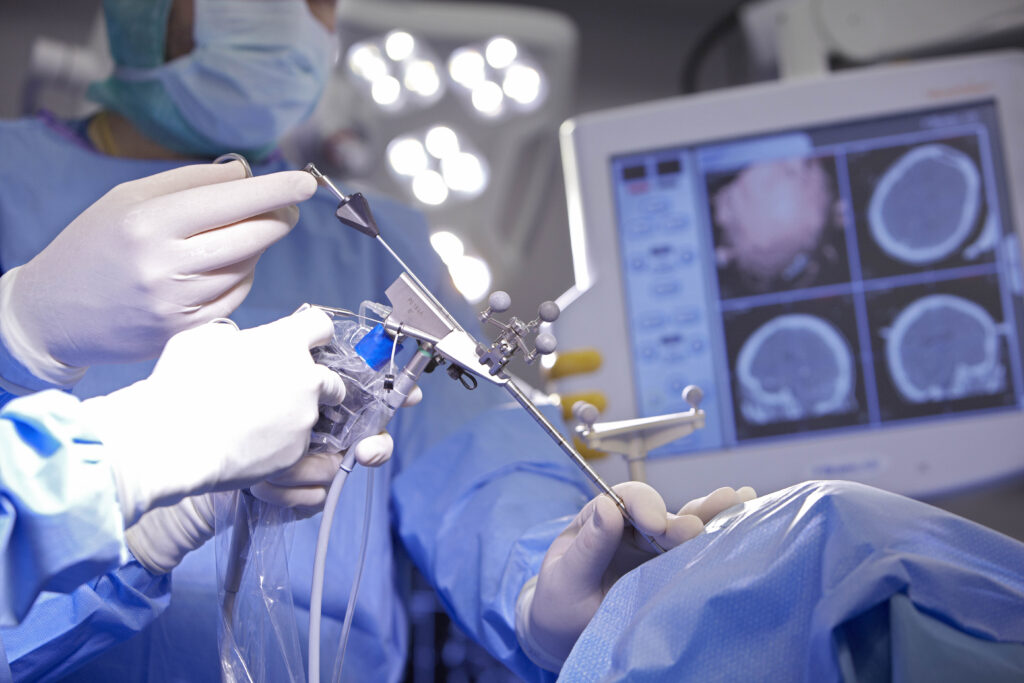 Neuroendoscopy Devices Market