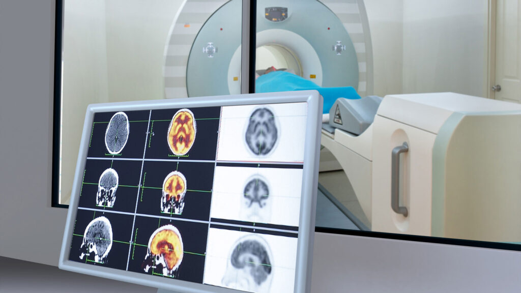 Nuclear Medicine Equipment Market