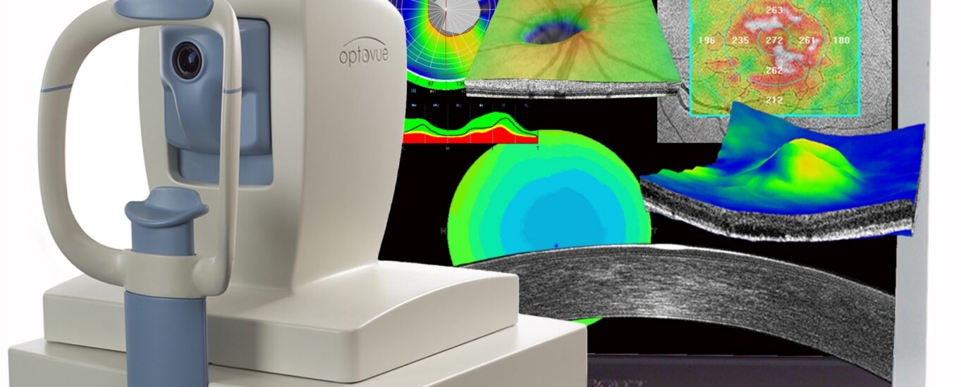 Global Optical Coherence Tomography Industry