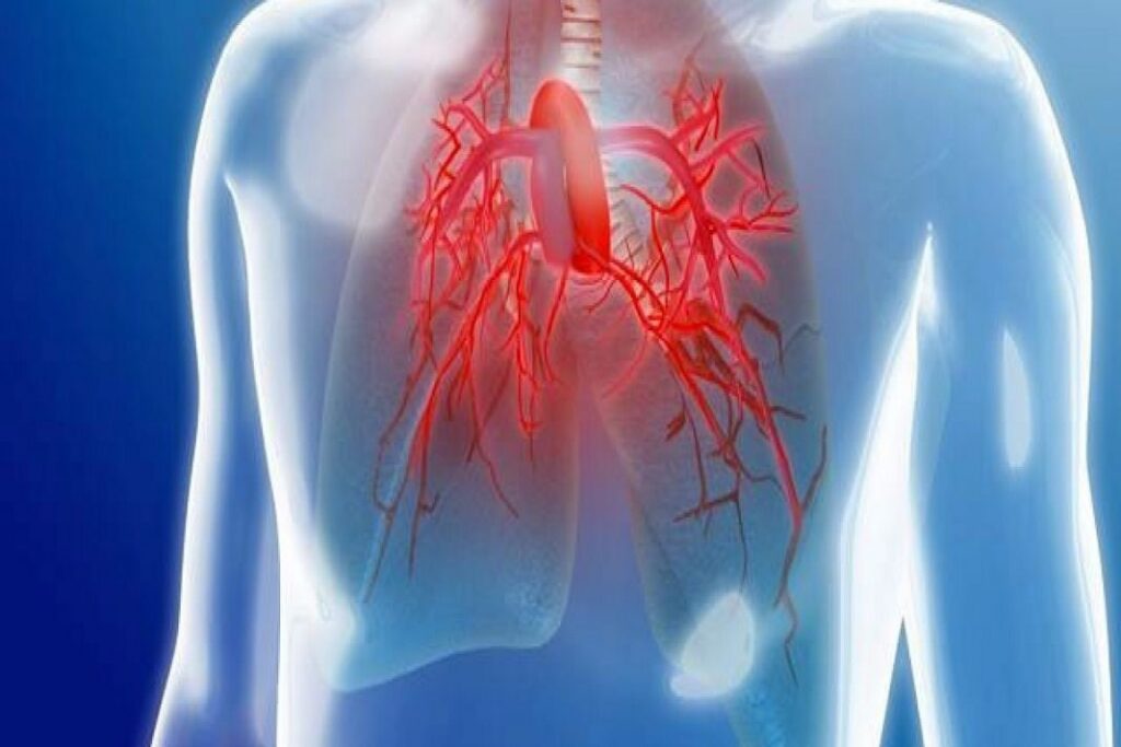 Pulmonary Arterial Hypertension Treatment Market