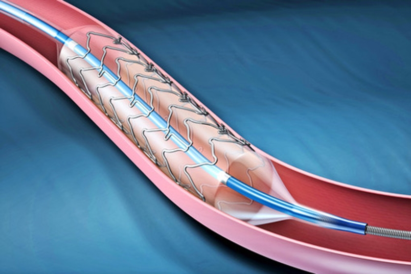 Thoracic Vascular Stent Grafts Market