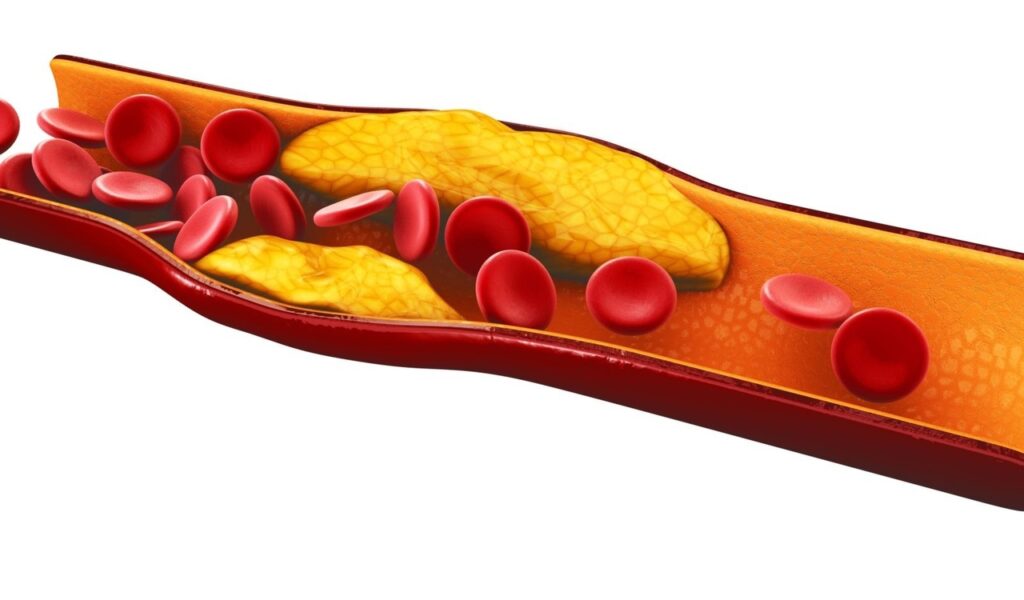 Cholesterol Monitors Market