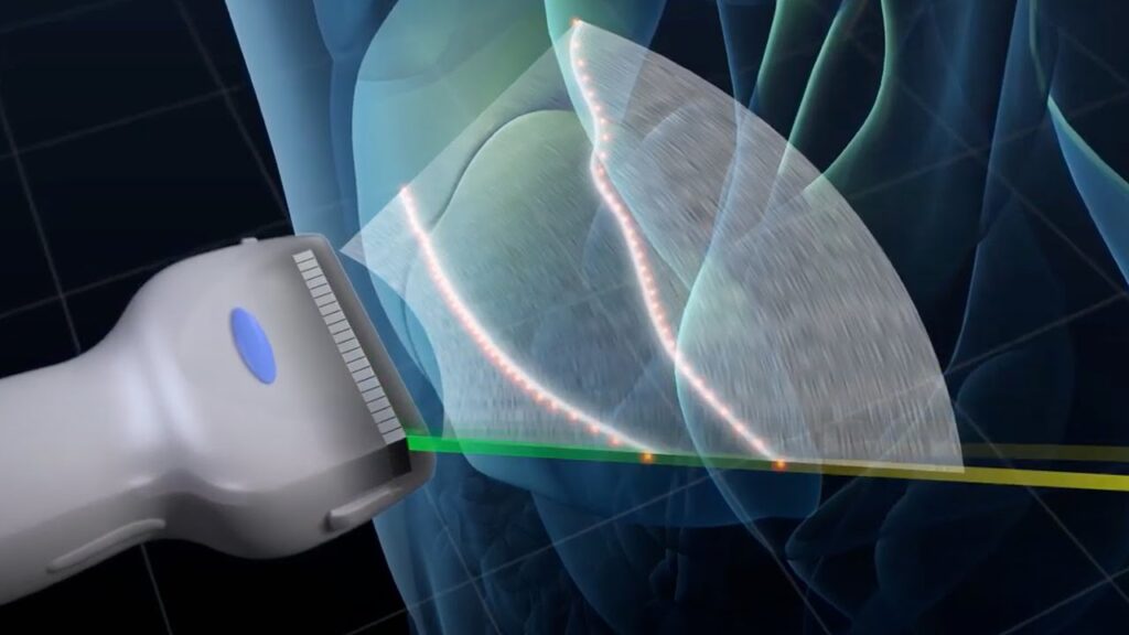 Dental Piezoelectric Ultrasonic Unit