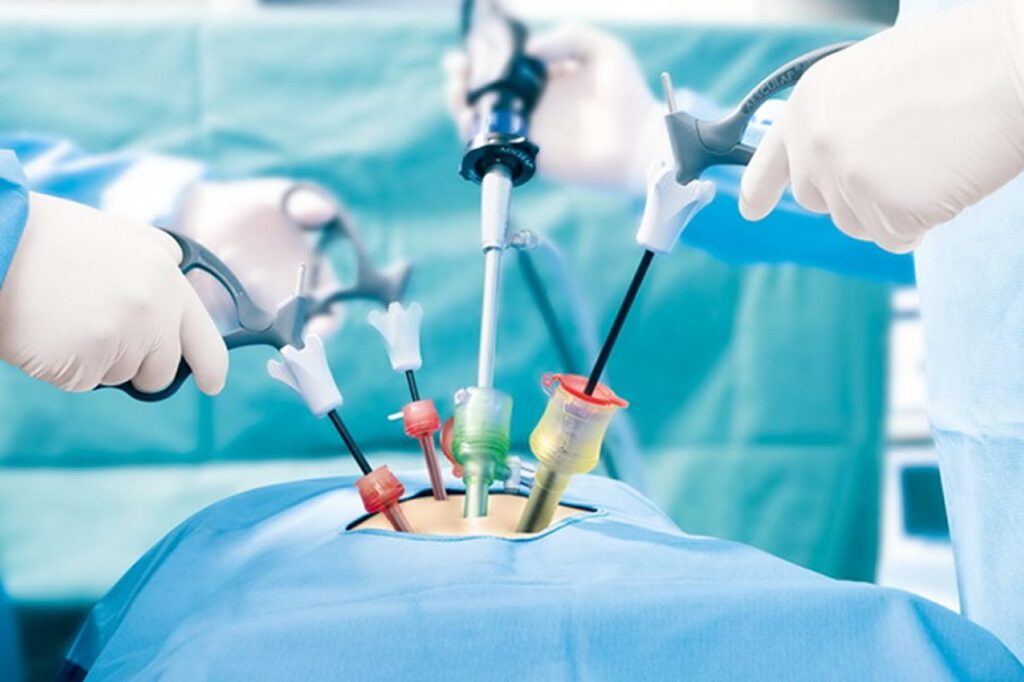 Global Bariatric Surgery Device Market