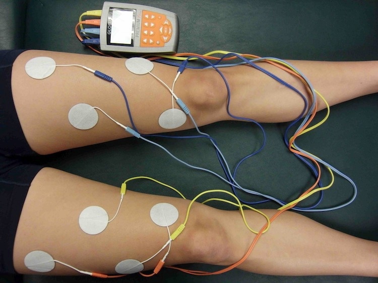 Functional Electrical Stimulation Market