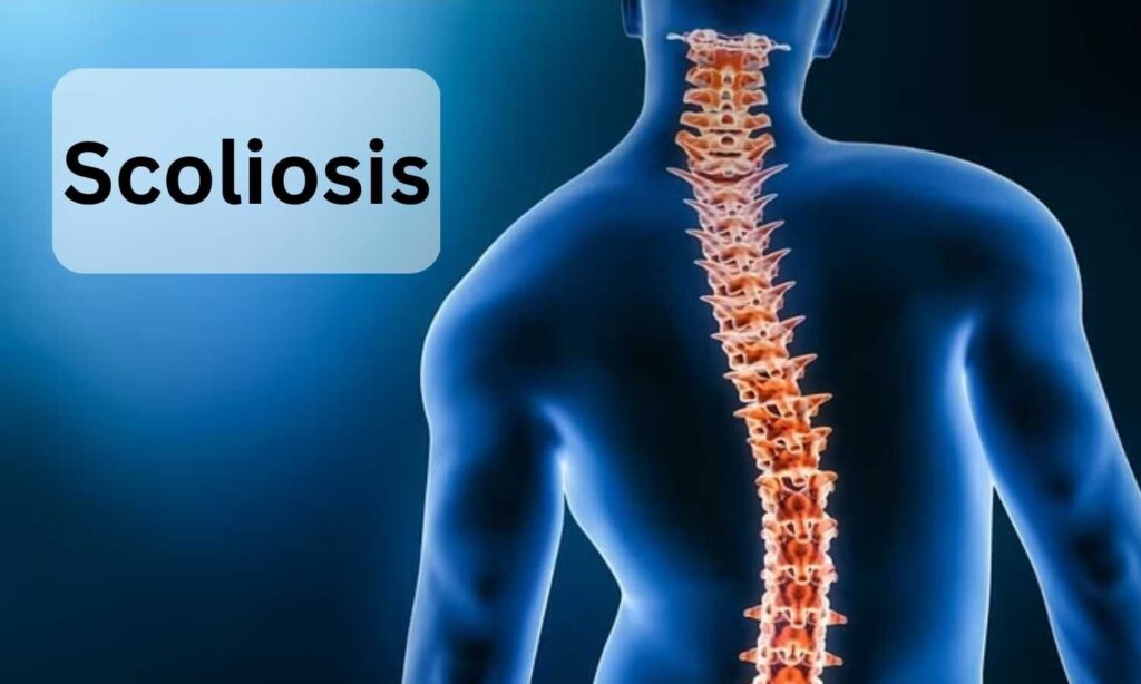 Global Scoliosis Management Market