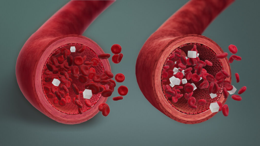 Hyperinsulinemia Hypoglycaemia Treatment Market