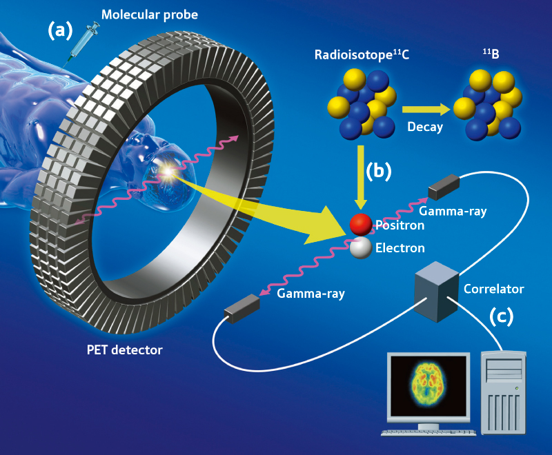 Molecular Imaging Market