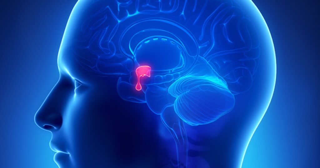 Pituitary Stalk Interruption Syndrome Treatment Market