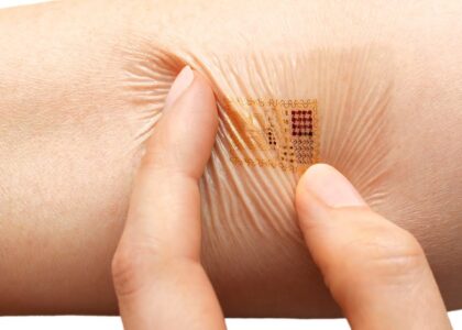 Stretchable Electronics Market