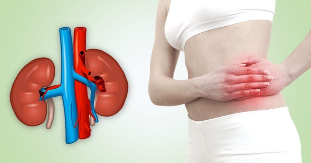 APOL1-Mediated Kidney Disease Market