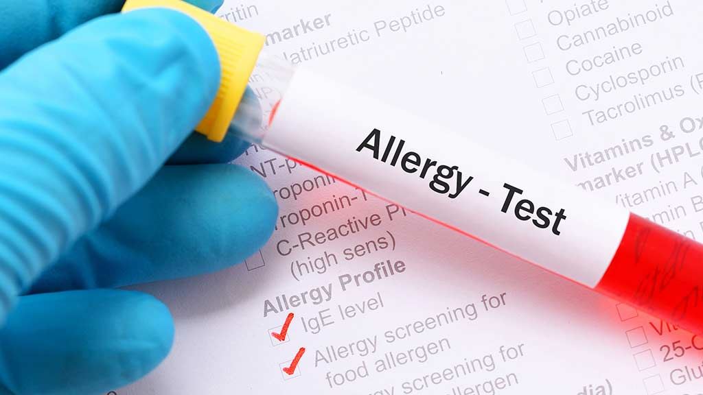 Allergy Diagnostics