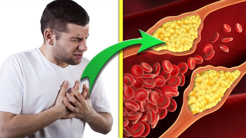 Cholesterol Monitors Market