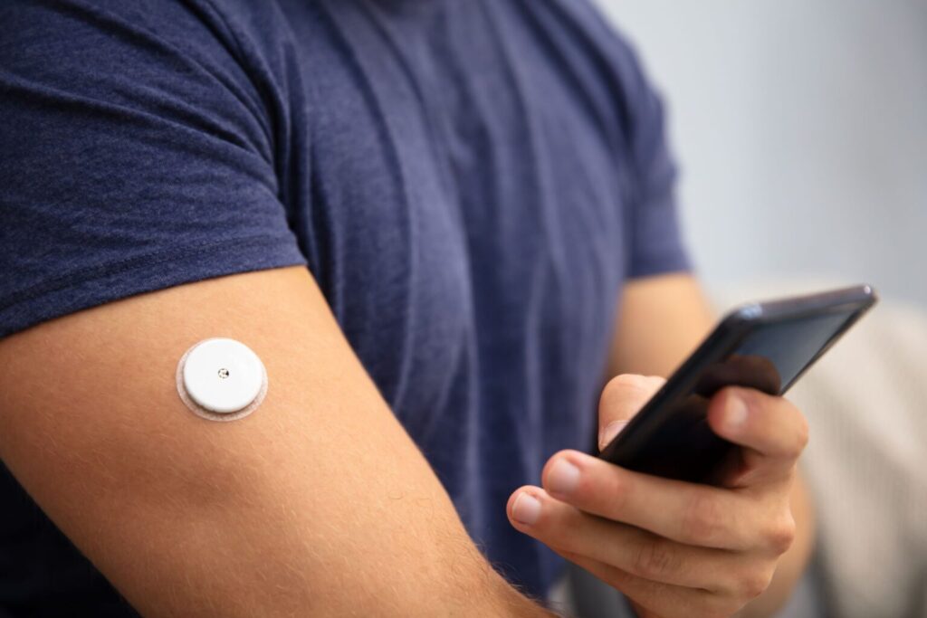 Continuous Glucose Monitoring Device Market