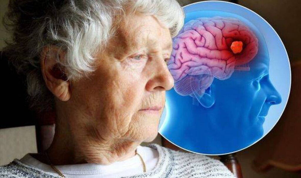 Frontotemporal Dementia Management Market