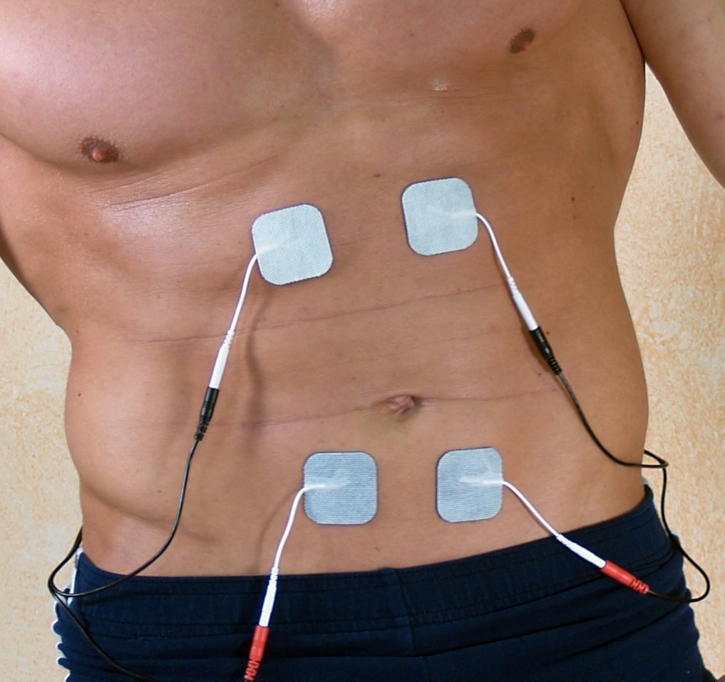 Gastric Electrical Stimulator