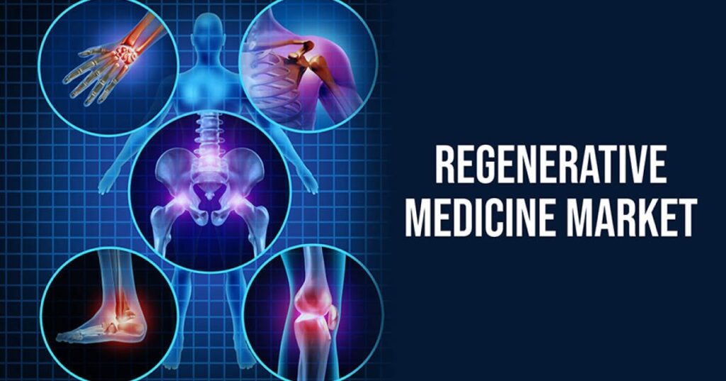 Regenerative Medicine Market