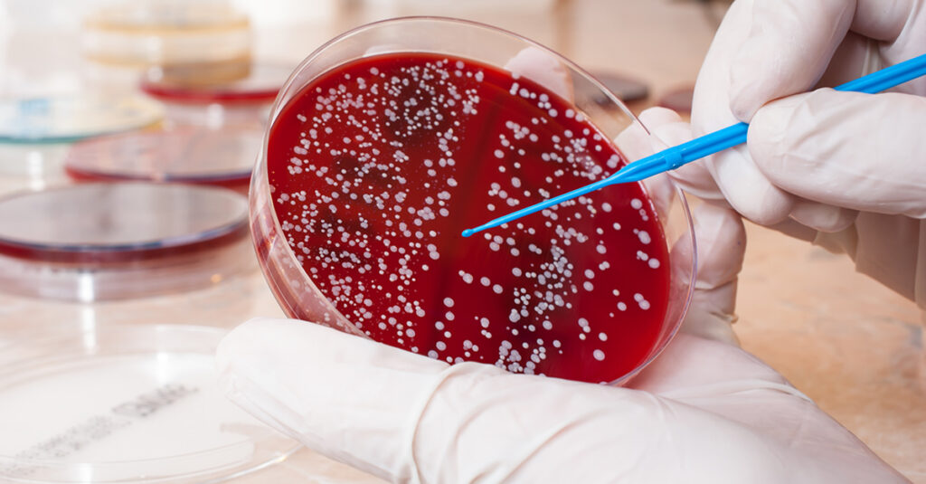 Staphylococcus Aureus Testing Market