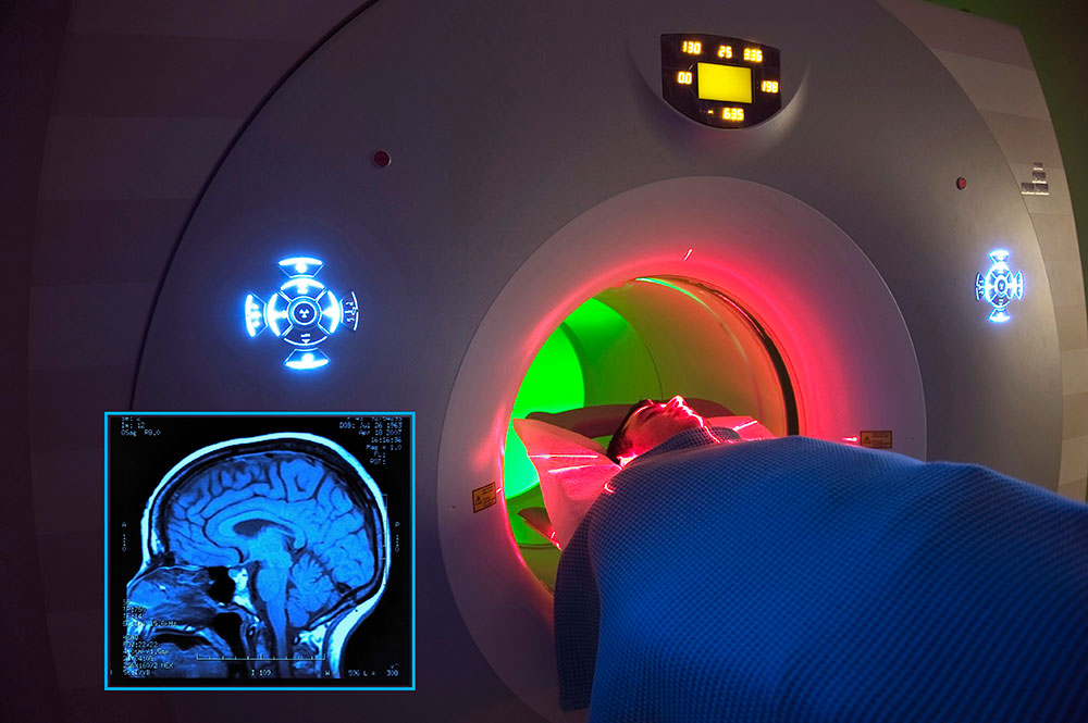 Magnetic Resonance Imaging (MRI) Contrast Agents Market