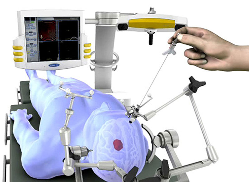 Neuronavigation Systems Market