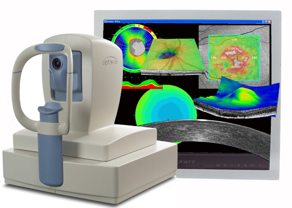 Optical Coherence Tomography Market