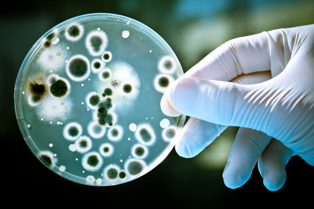 Anti-microbial/Anti-fungal Tests Market