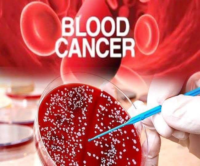 Blood Cancer Treatment