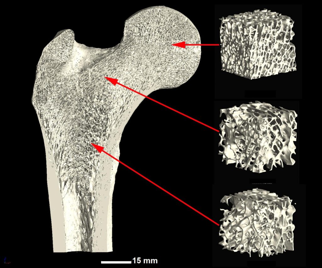 Bone Regeneration