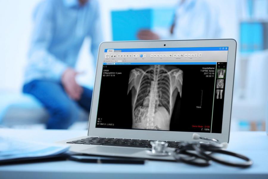 Global Digital Radiography Detectors Market