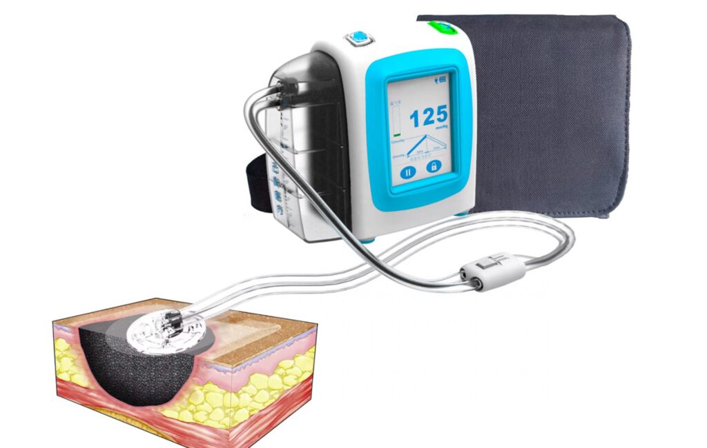 Disposable Negative Pressure Wound Therapy Devices Market 