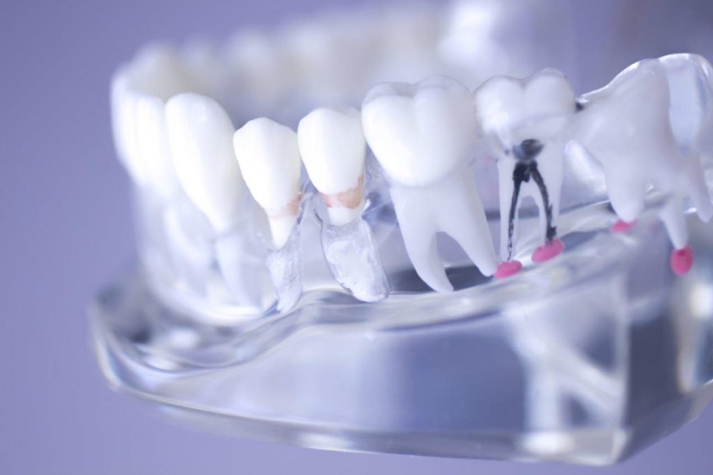 Endodontics and Orthodontics Market