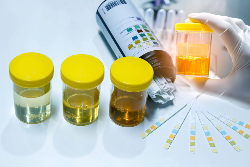 Genomic Urine Testing Market