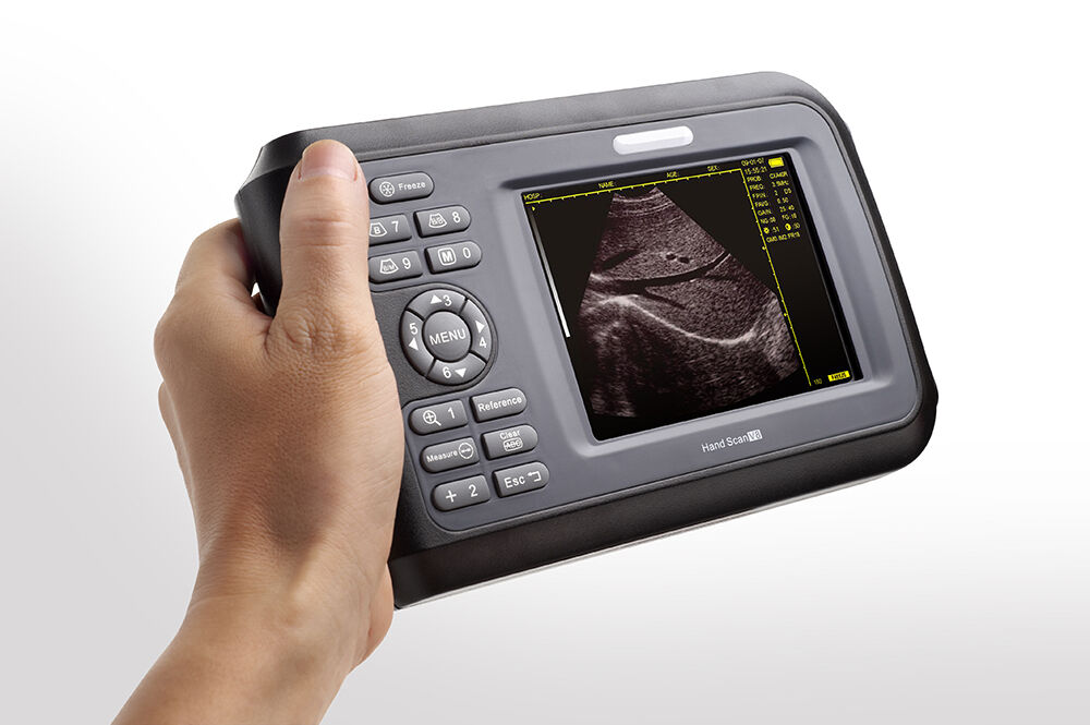 Handheld Ultrasound Scanners Market