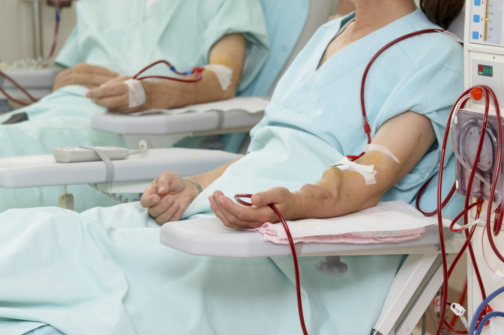 Hemodialysis and Peritoneal Dialysis