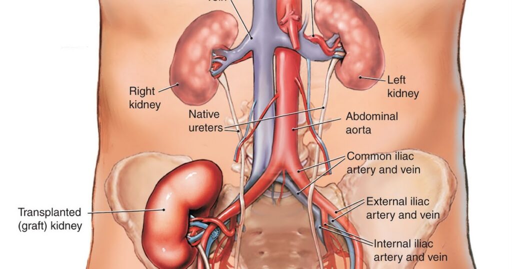 Kidney Transplant Market