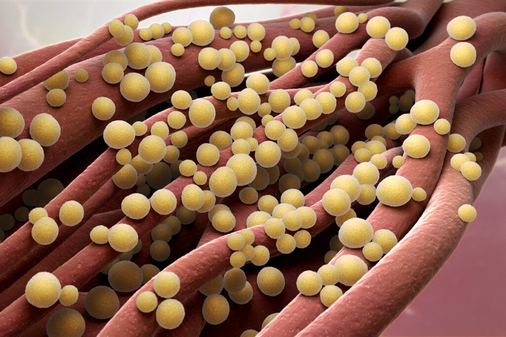 Methicillin-Resistant Staphylococcus Aureus (MRSA) Treatment Market