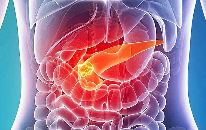 Neuroendocrine Carcinoma Treatment Market