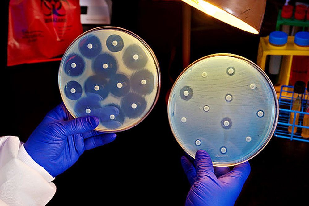 Antibiotic Susceptibility Testing Market