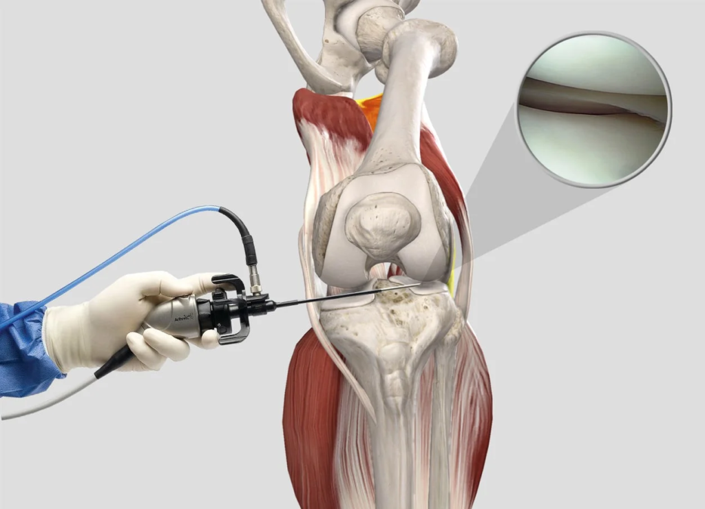 Arthroscopy Visualization Systems Market