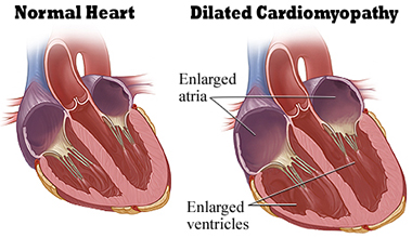 Canine Dilated Cardiomyopathy Drugs Market