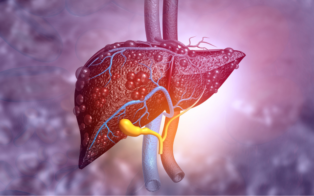 Cirrhosis Management Market