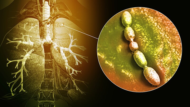 Community Acquired Bacterial Pneumonia (CABP) Treatment Market