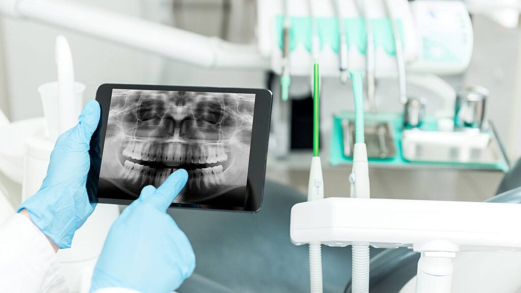 Dental X-Ray Systems Market