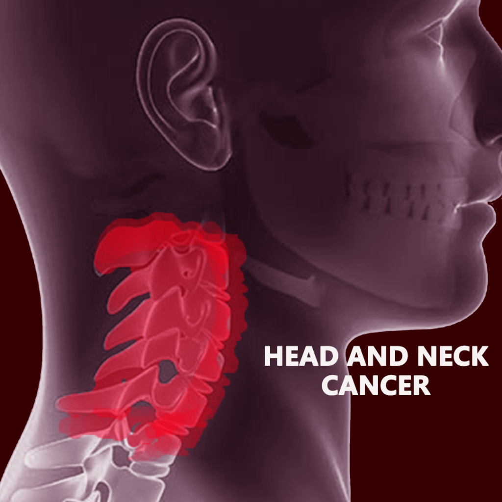 Head and Neck Cancer Therapeutics Market