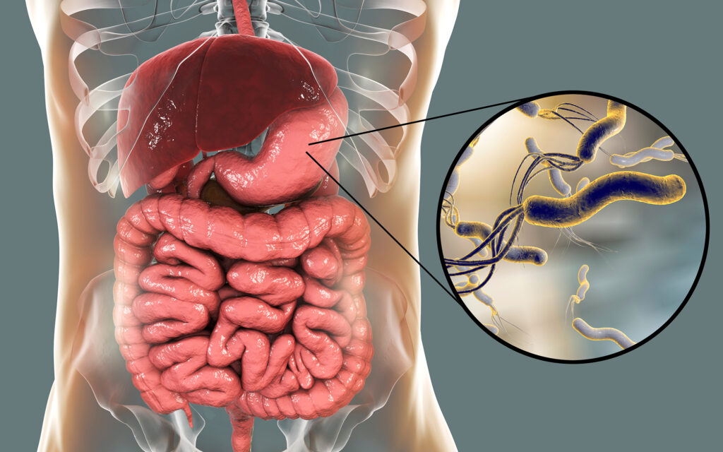 Helicobacter Pylori Non-Invasive Testing Market